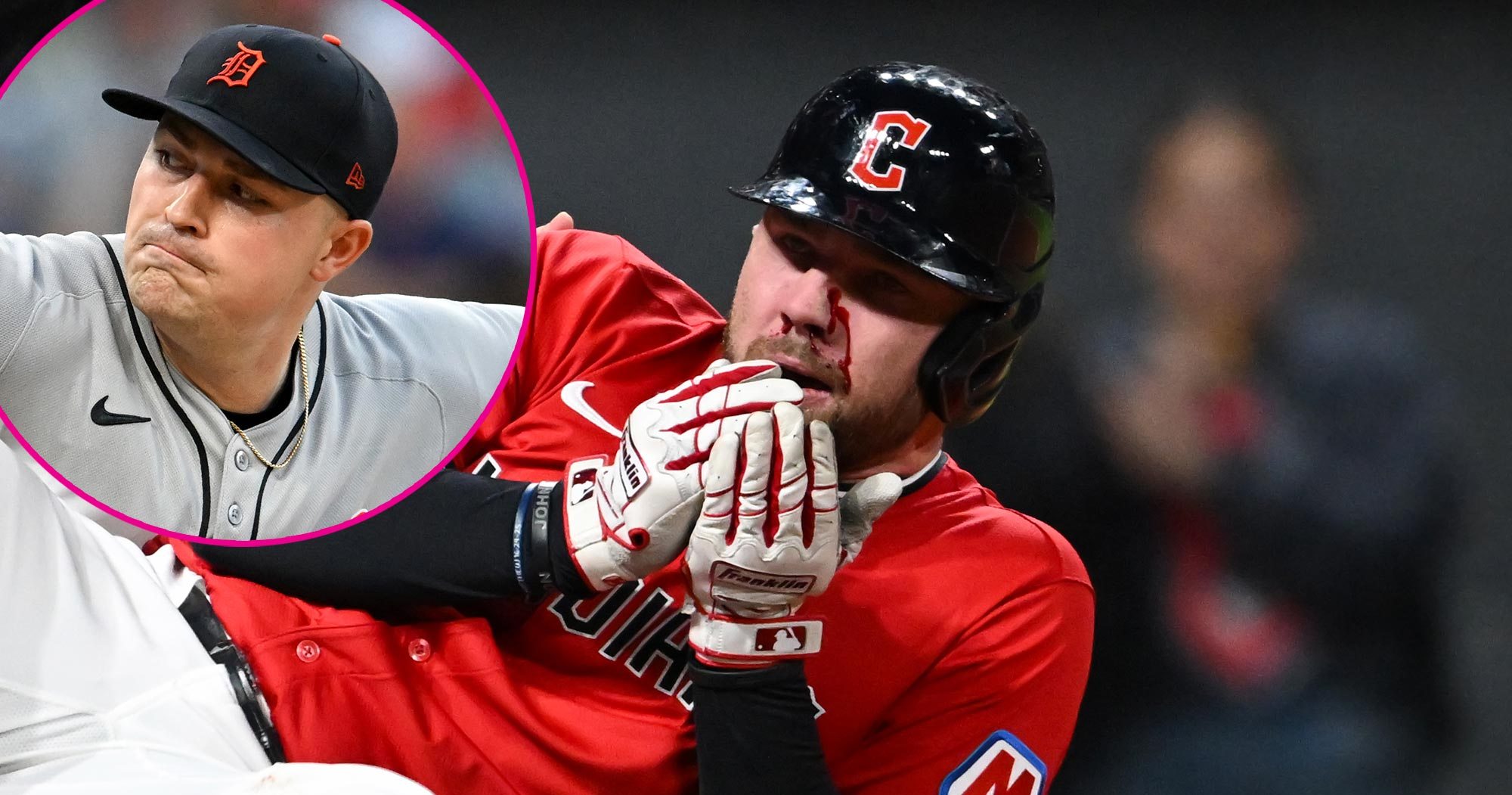 Tarik Skubal Reaches Out to David Fry Following Fractured Face Incident