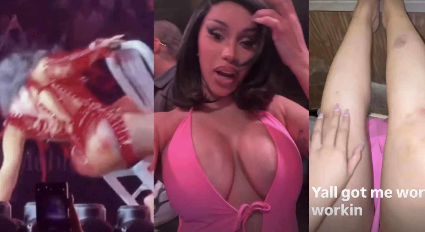 Cardi B Takes a Wild Spill Off Chair During 'Little Miss Drama' Tour